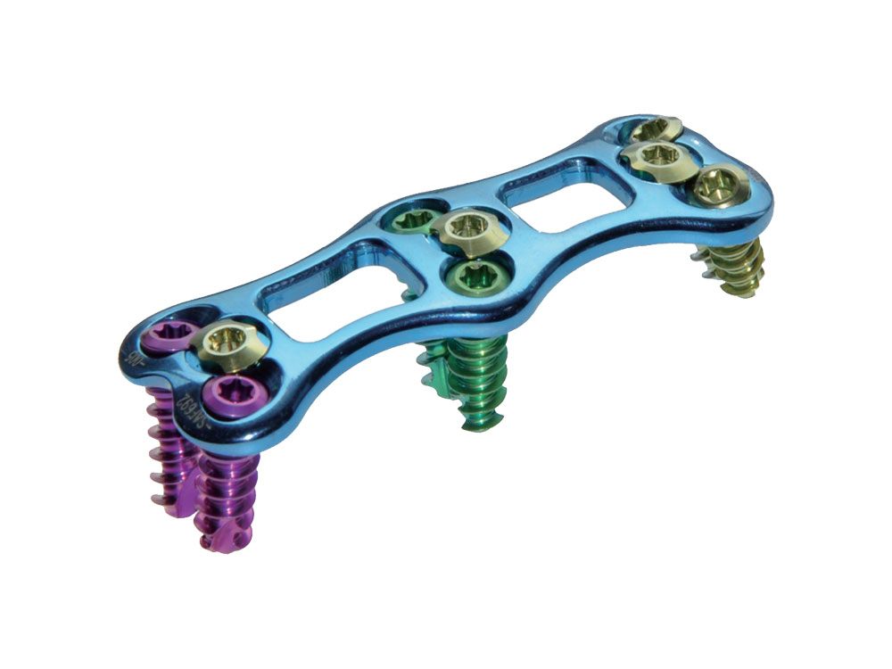 Anterior Cervical Locking Fixation System (VI)